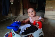 Perjuangan Elvano, Bocah Penderita Jantung Bawaan dari Ujung Tanggamus